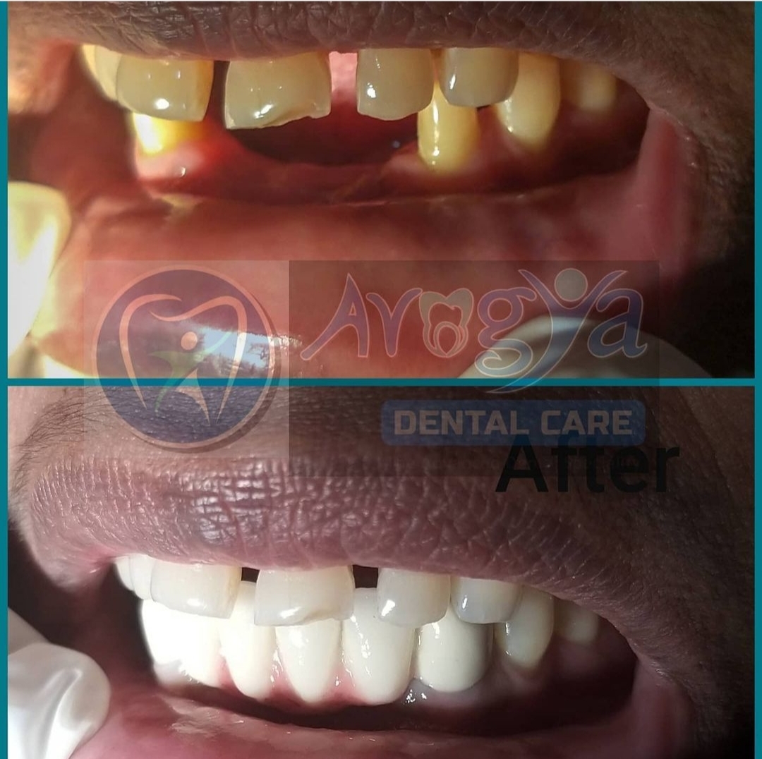 Arogya Family Dental Clinic